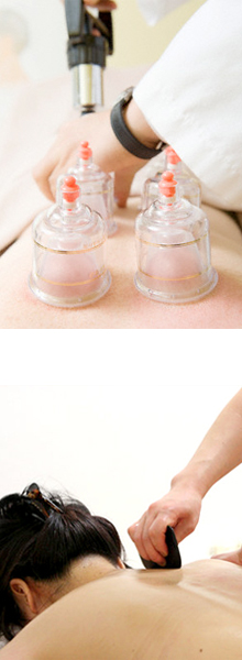 Cupping and Gua Sha